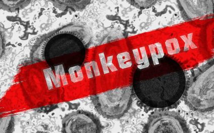 hMPXV Virus aka Monkeypox