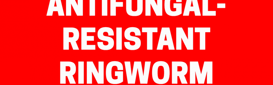Antifungal-Resistant Ringworm