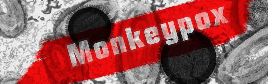 hMPXV Virus aka Monkeypox