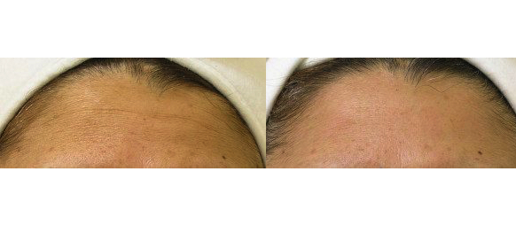 Corrective Skin