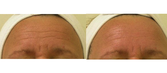 Corrective Skin