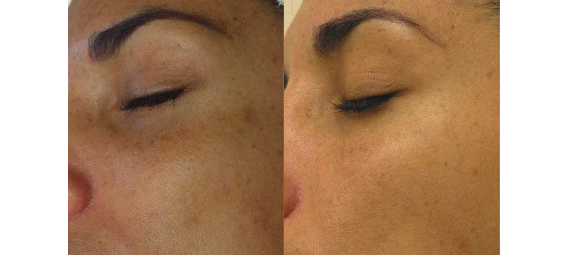 Corrective Skin