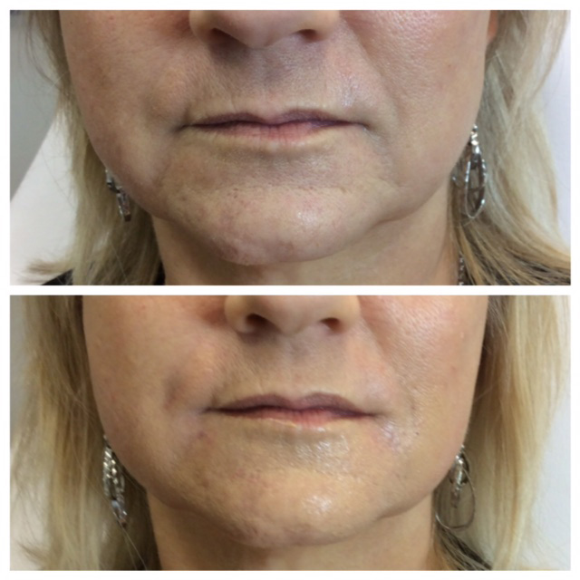 Cosmetic Injectables & Specialty Treatments Image