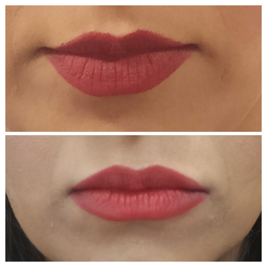 Cosmetic Injectables & Specialty Treatments Image