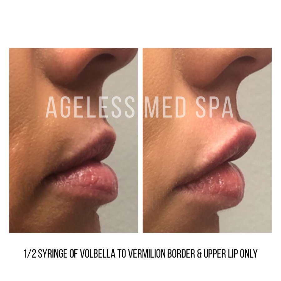 Cosmetic Injectables & Specialty Treatments Image
