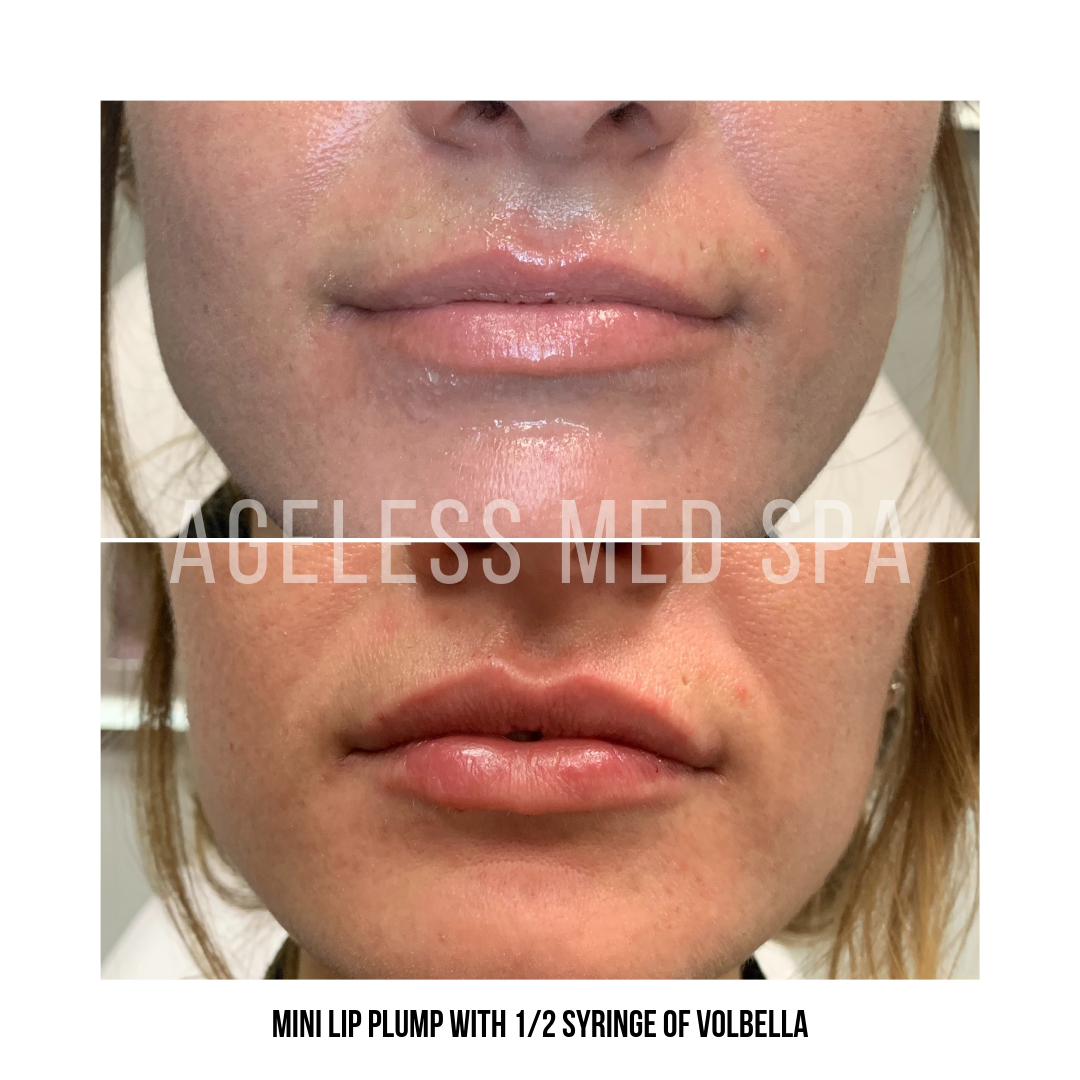 Cosmetic Injectables & Specialty Treatments Image