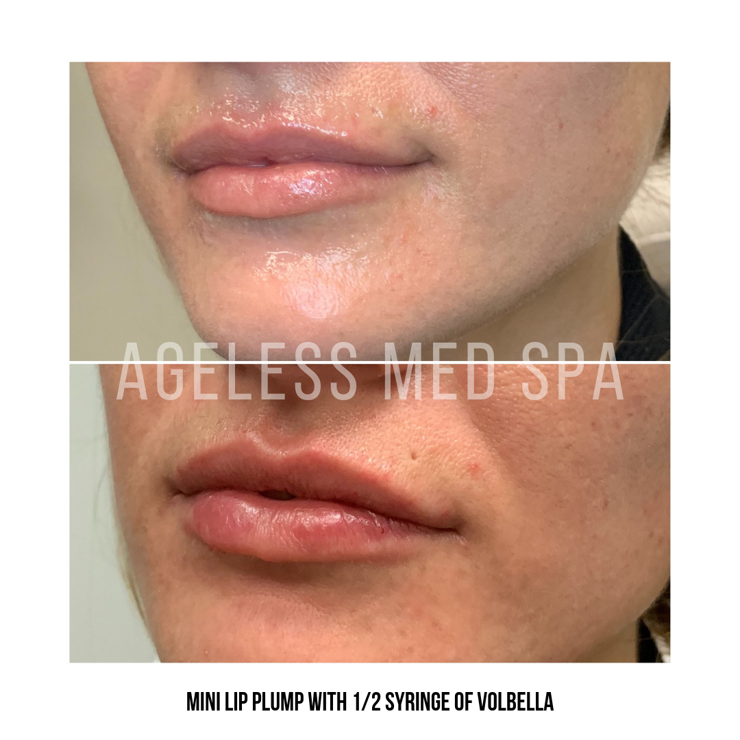 Cosmetic Injectables & Specialty Treatments Image
