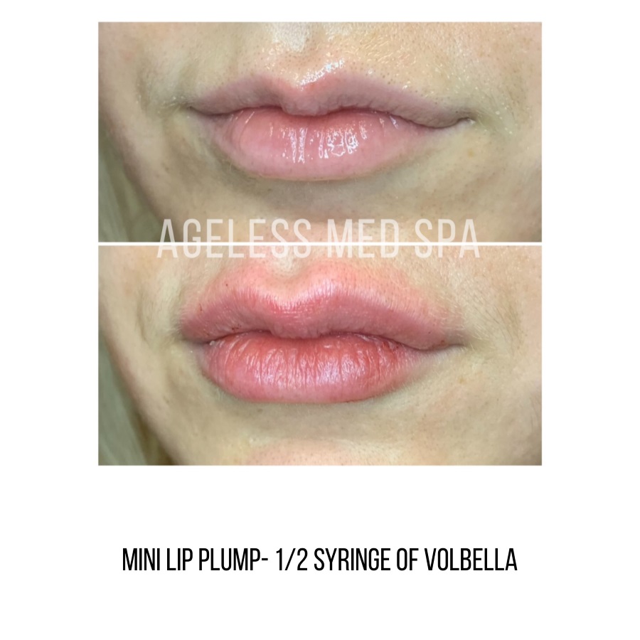 Cosmetic Injectables & Specialty Treatments Image