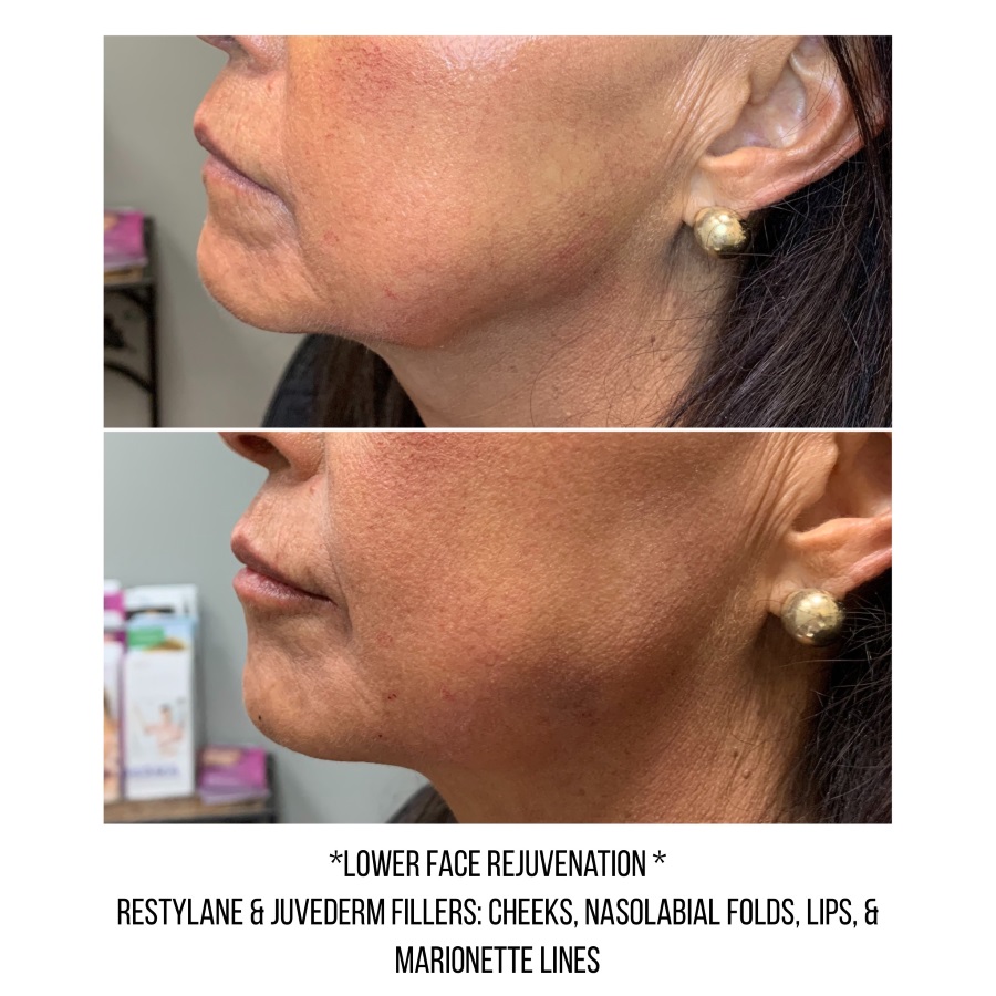 Cosmetic Injectables & Specialty Treatments Image