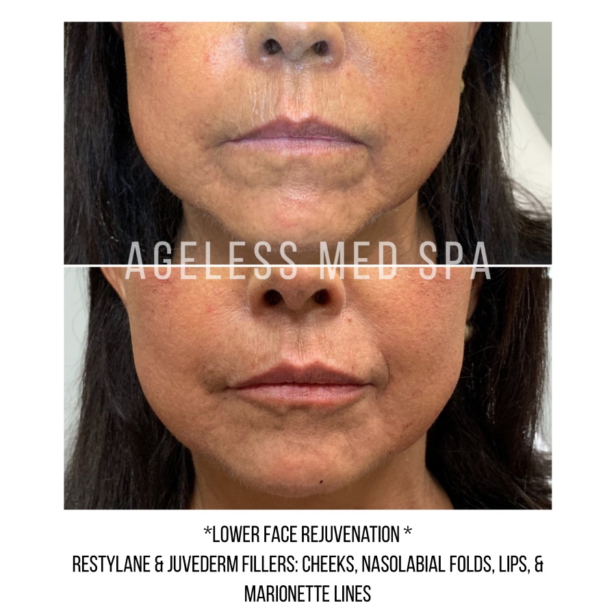Cosmetic Injectables & Specialty Treatments Image