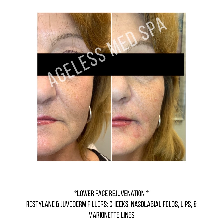 Cosmetic Injectables & Specialty Treatments Image
