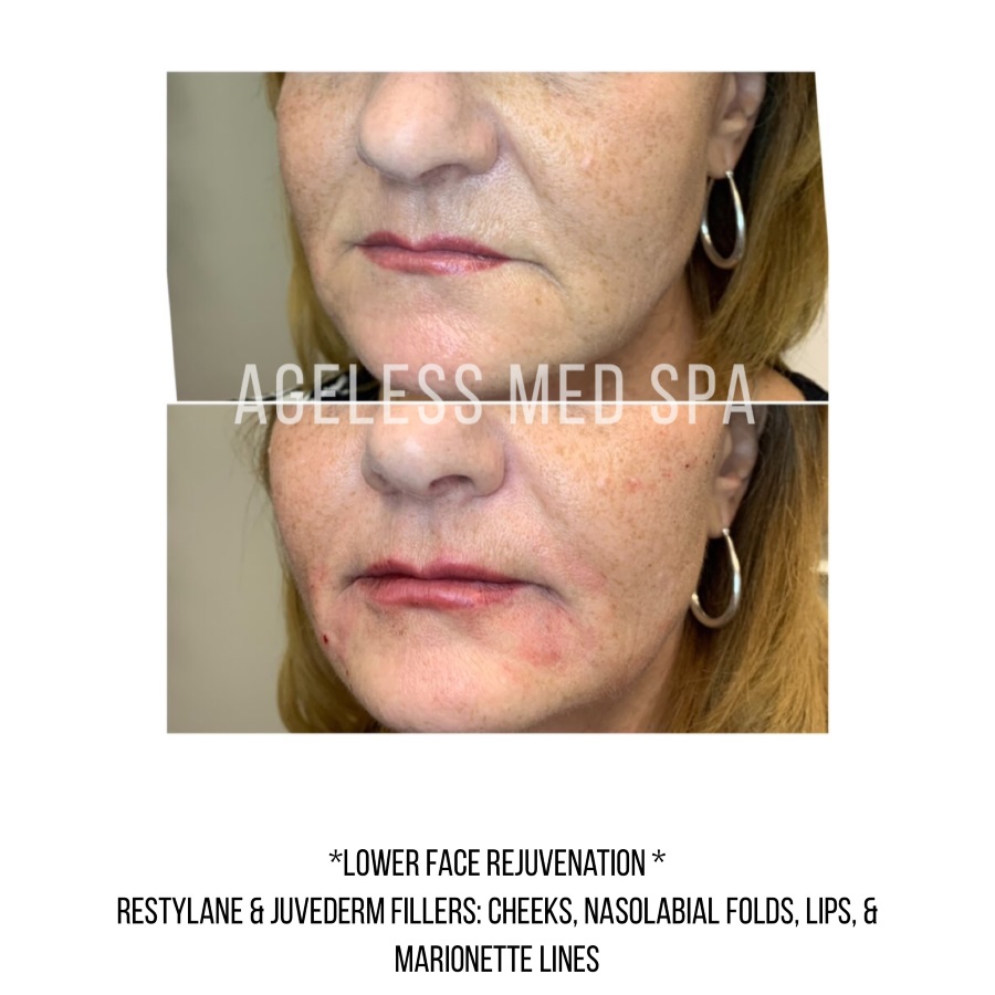 Cosmetic Injectables & Specialty Treatments Image
