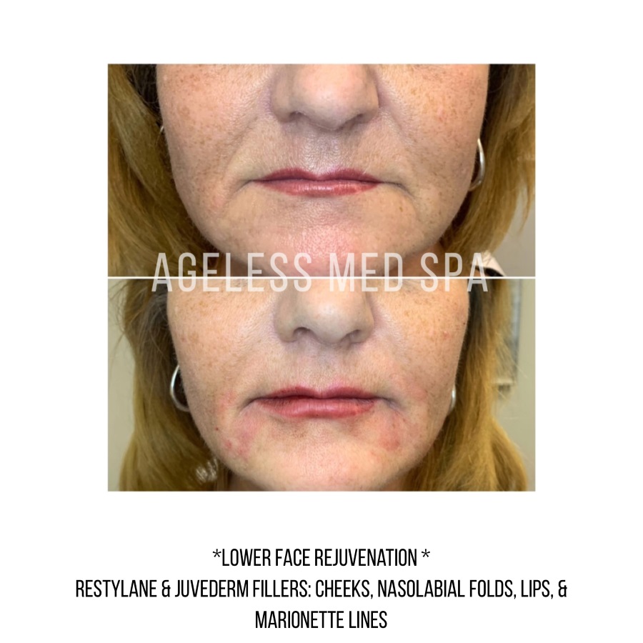 Cosmetic Injectables & Specialty Treatments Image