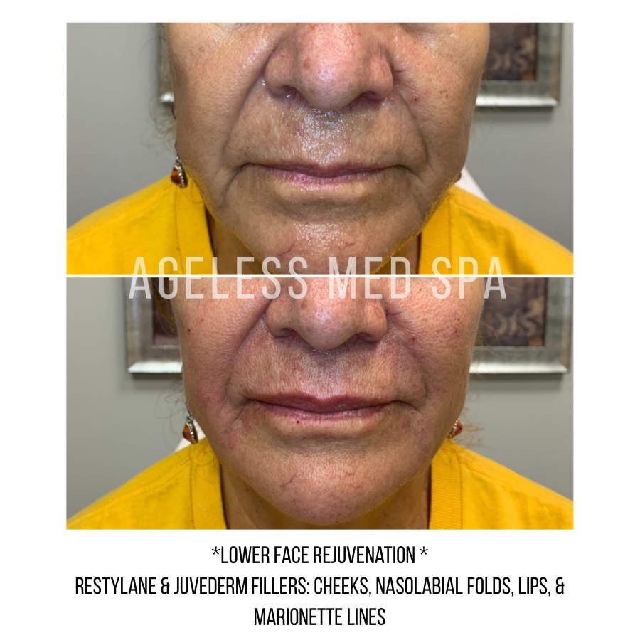 Cosmetic Injectables & Specialty Treatments Image