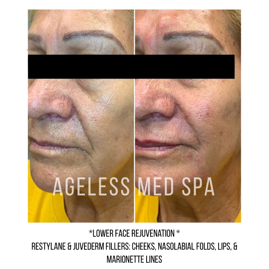 Cosmetic Injectables & Specialty Treatments Image