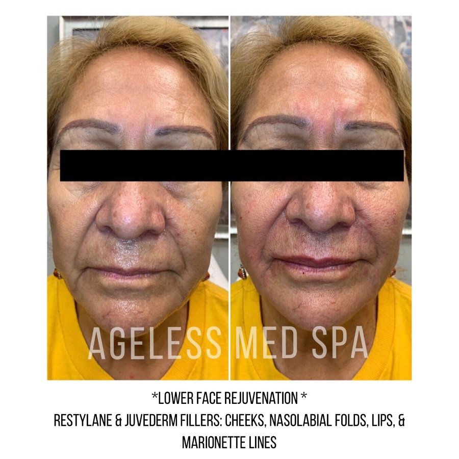 Cosmetic Injectables & Specialty Treatments Image