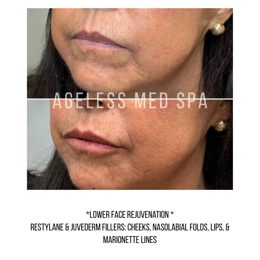 Cosmetic Injectables & Specialty Treatments Image
