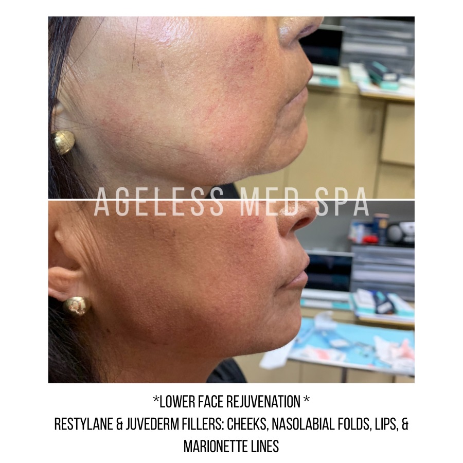 Cosmetic Injectables & Specialty Treatments Image