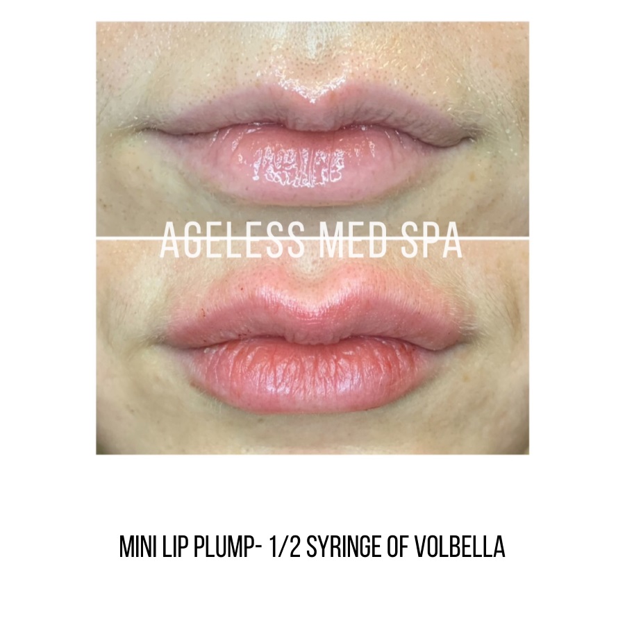 Cosmetic Injectables & Specialty Treatments Image