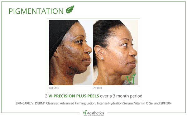 Corrective Skin