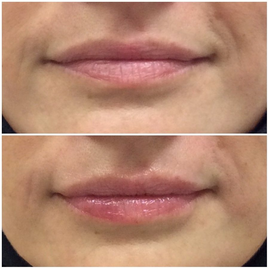 Cosmetic Injectables & Specialty Treatments Image