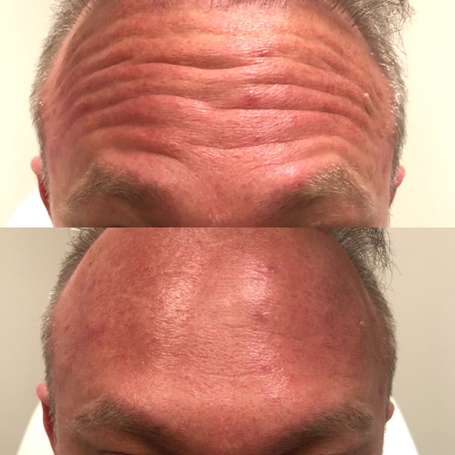 Cosmetic Injectables & Specialty Treatments Image