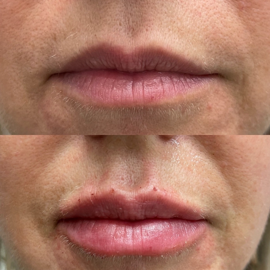 Cosmetic Injectables & Specialty Treatments Image