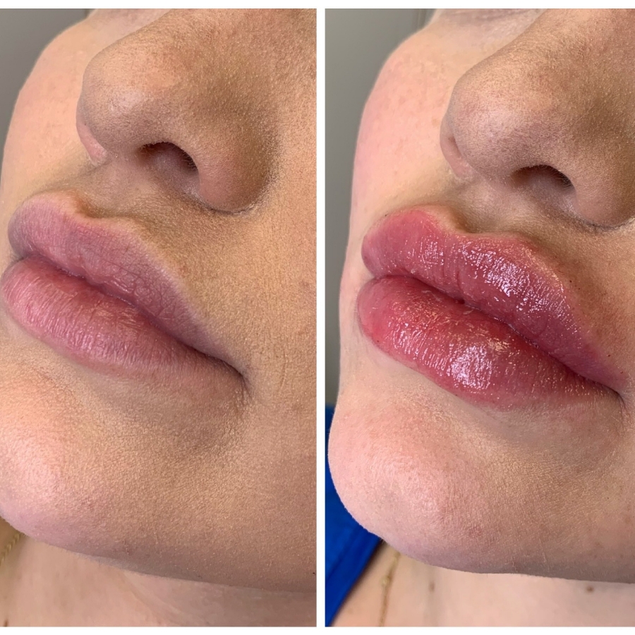 Cosmetic Injectables & Specialty Treatments Image