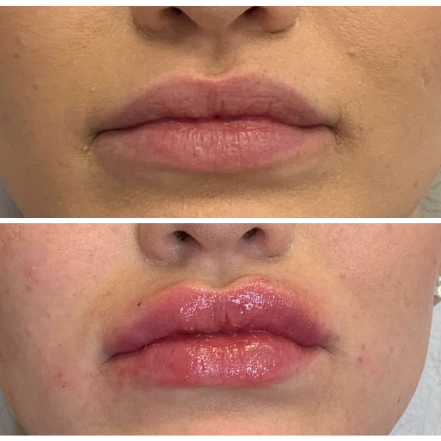 Cosmetic Injectables & Specialty Treatments Image