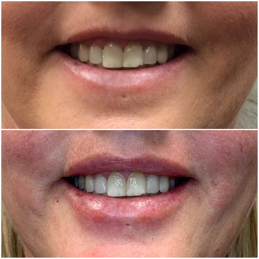 Cosmetic Injectables & Specialty Treatments Image