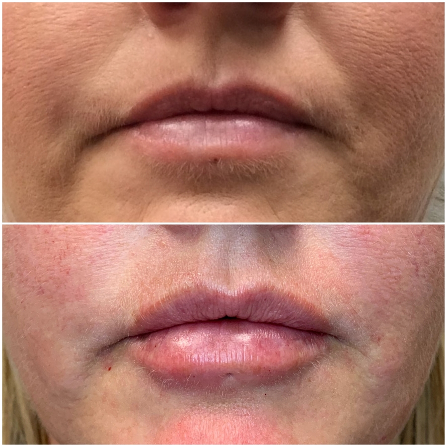 Cosmetic Injectables & Specialty Treatments Image