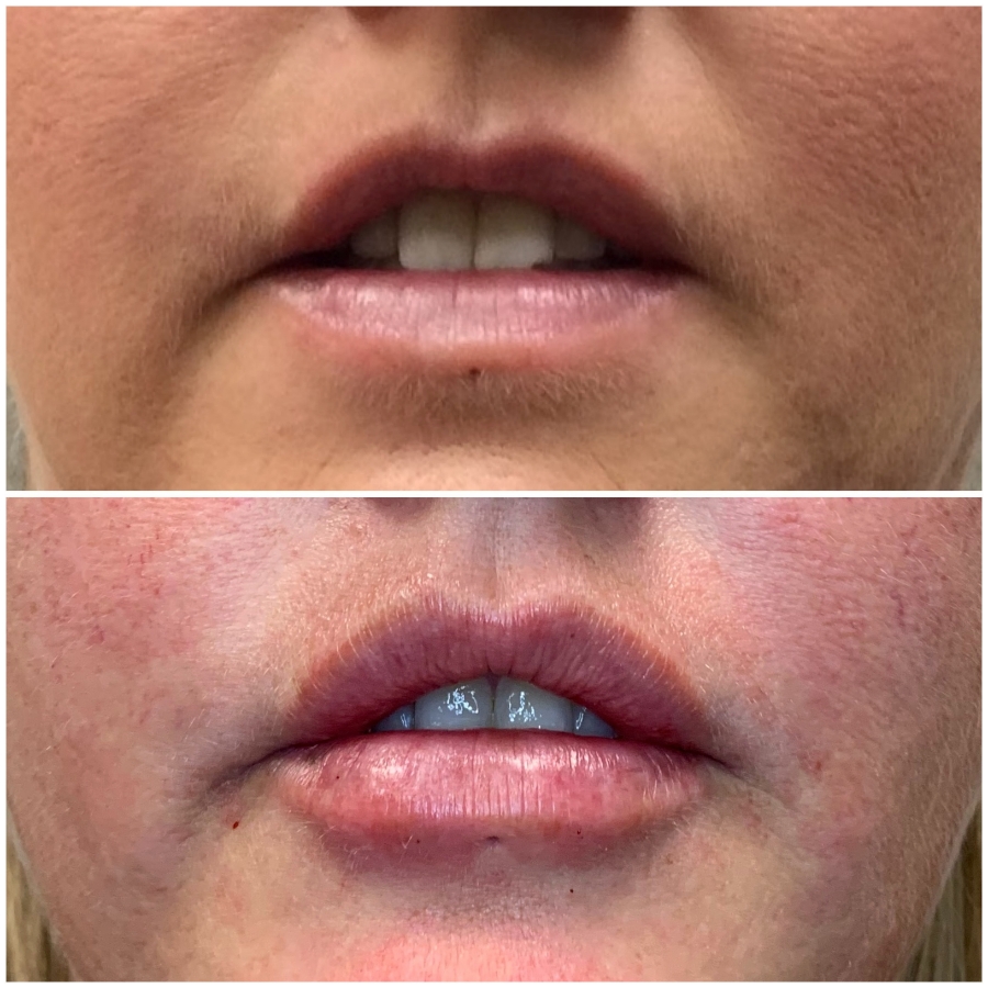 Cosmetic Injectables & Specialty Treatments Image