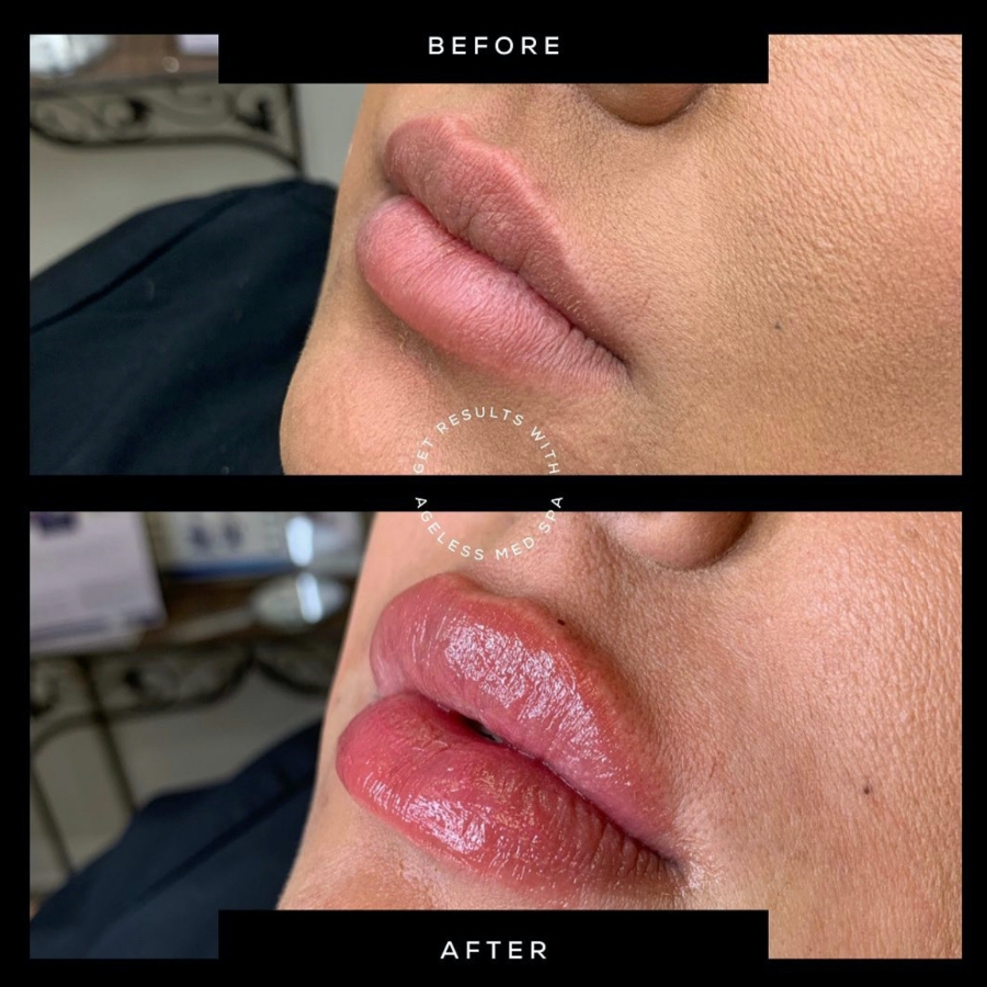 Cosmetic Injectables & Specialty Treatments Image