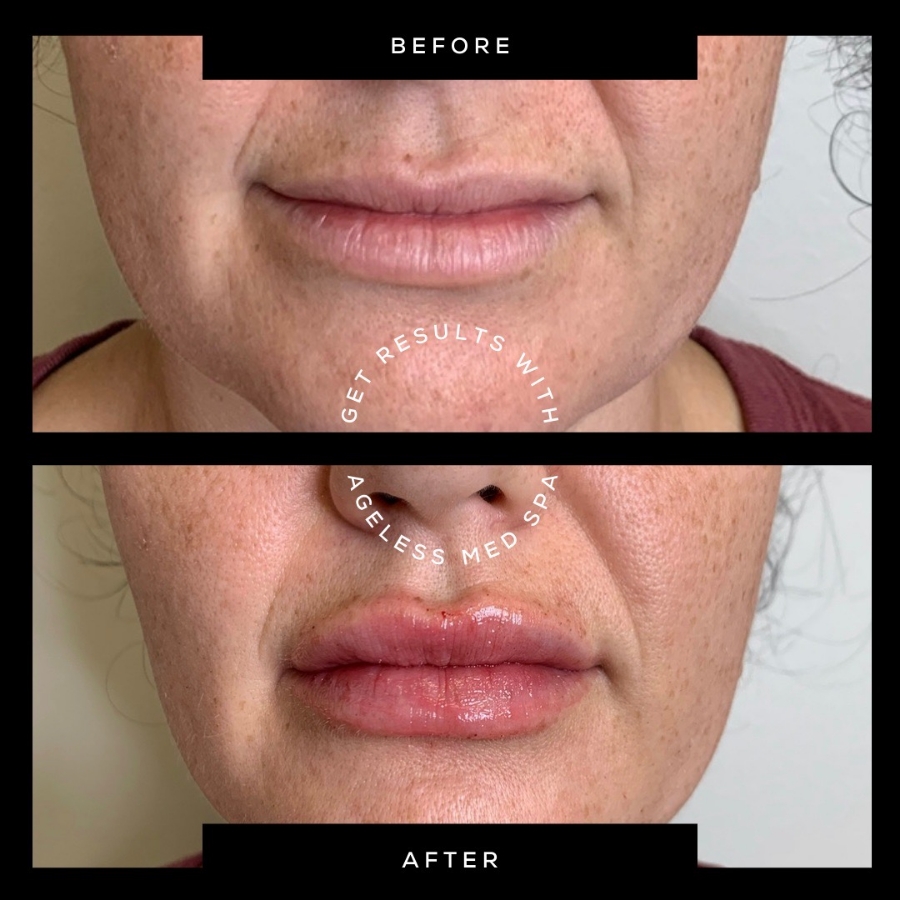 Cosmetic Injectables & Specialty Treatments Image