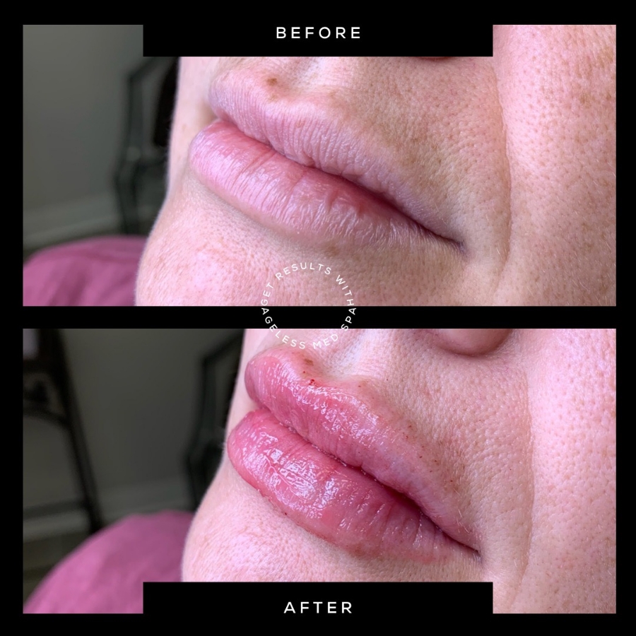 Cosmetic Injectables & Specialty Treatments Image