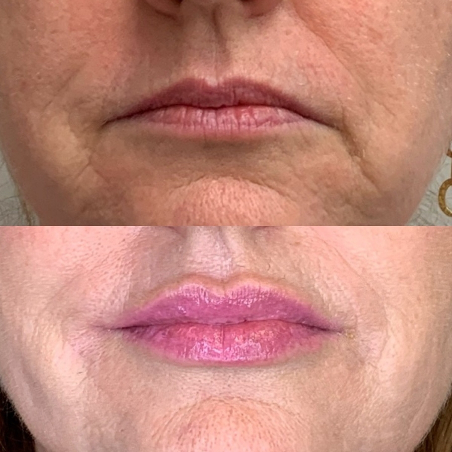 Cosmetic Injectables & Specialty Treatments Image