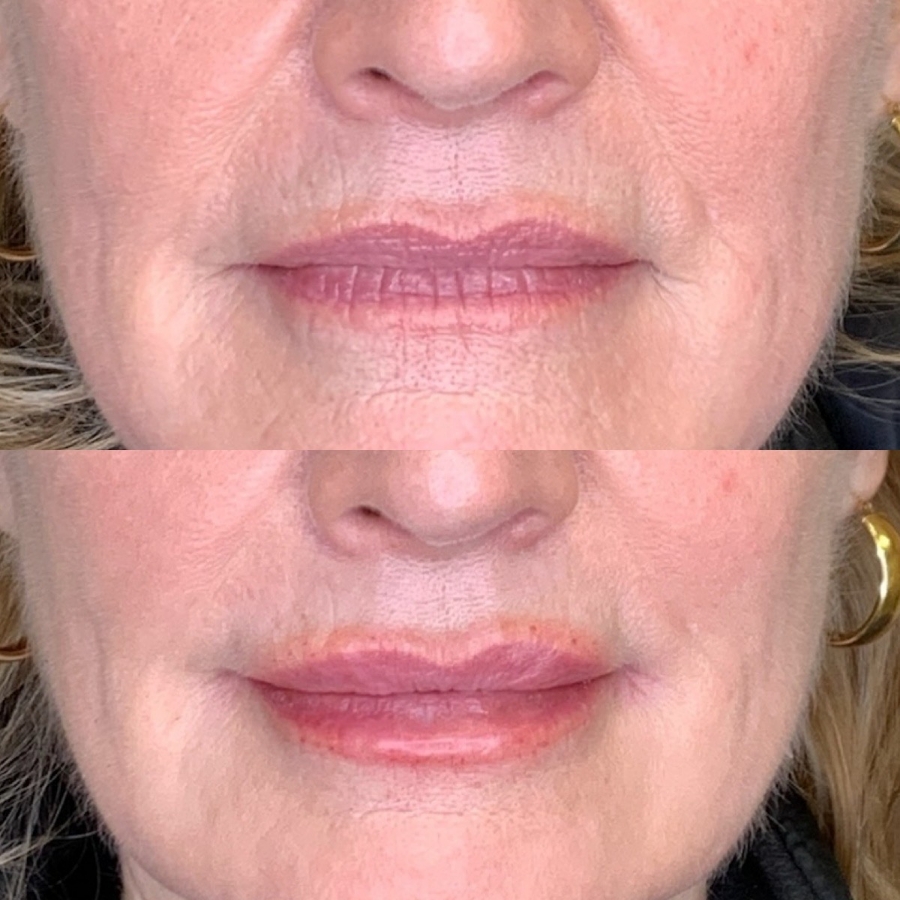 Cosmetic Injectables & Specialty Treatments Image