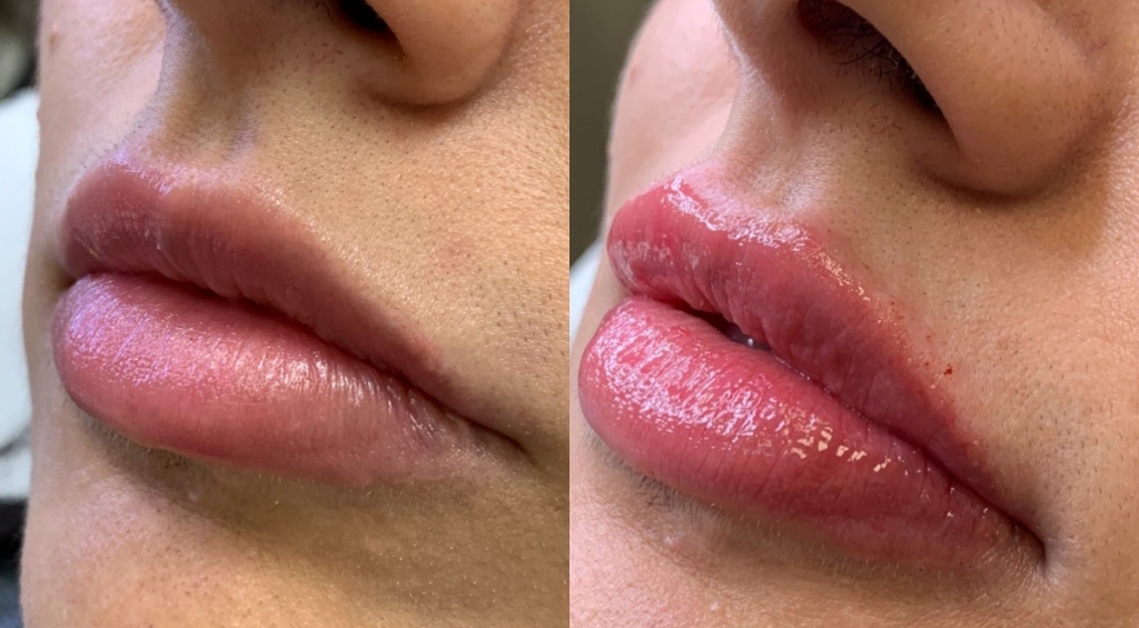 Cosmetic Injectables & Specialty Treatments Image