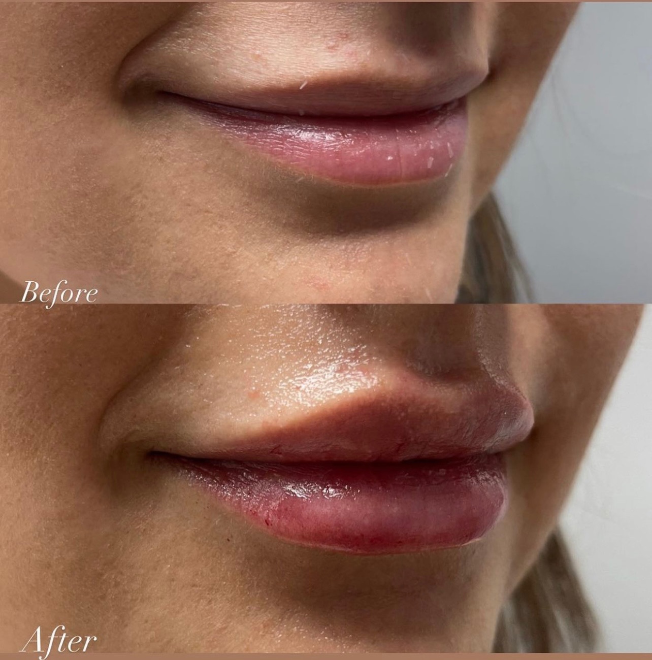 Cosmetic Injectables & Specialty Treatments Image