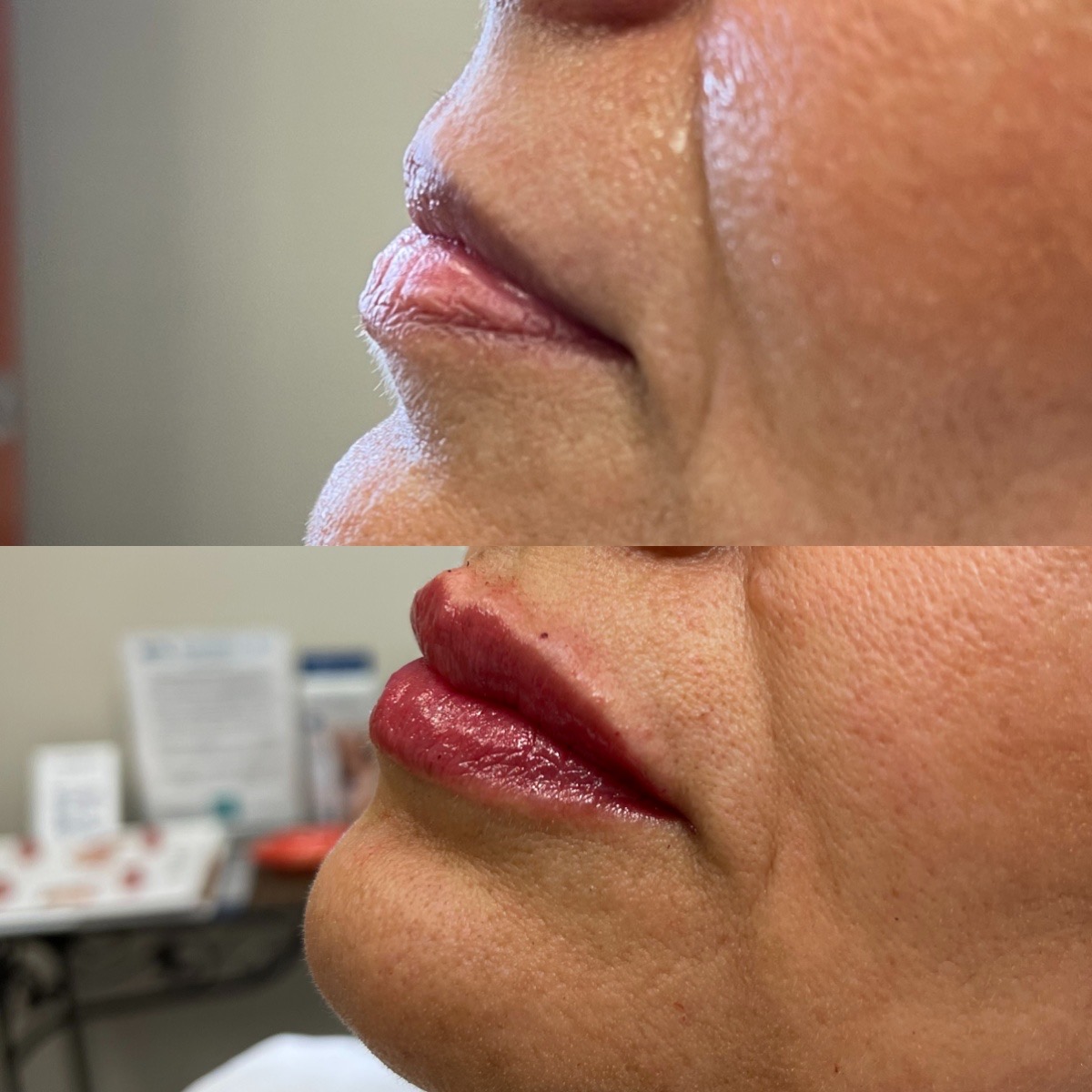 Cosmetic Injectables & Specialty Treatments Image