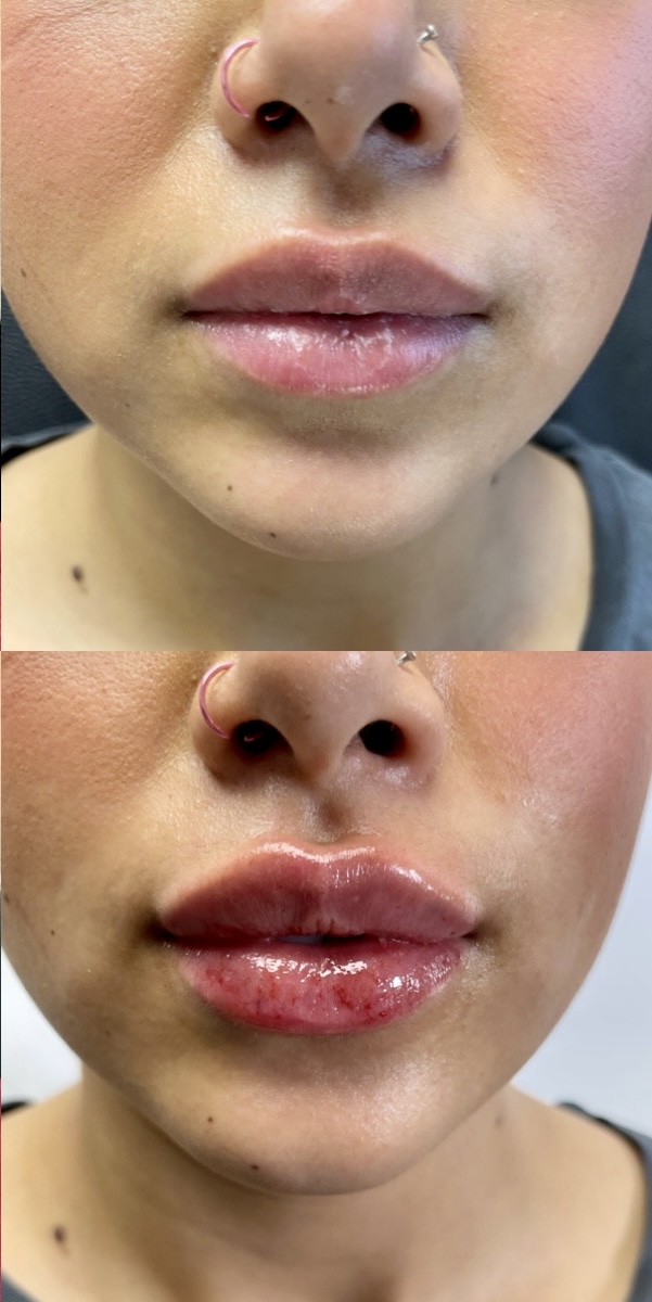Cosmetic Injectables & Specialty Treatments Image