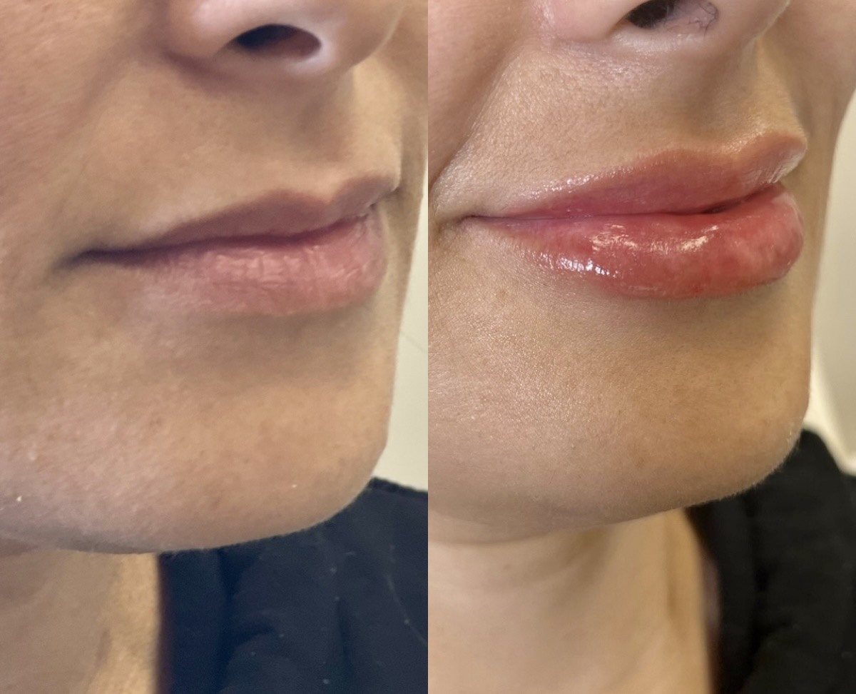 Cosmetic Injectables & Specialty Treatments Image