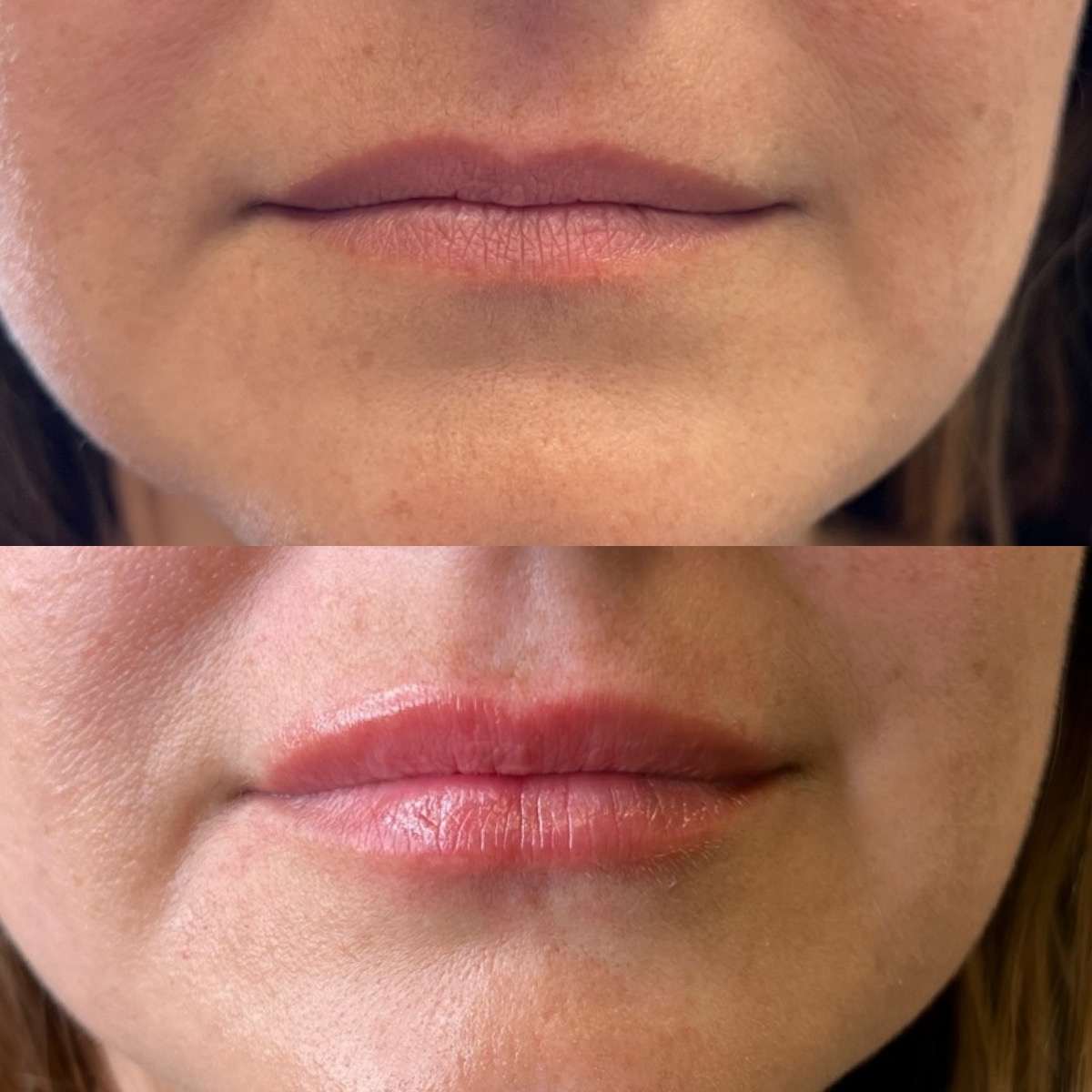 Cosmetic Injectables & Specialty Treatments Image