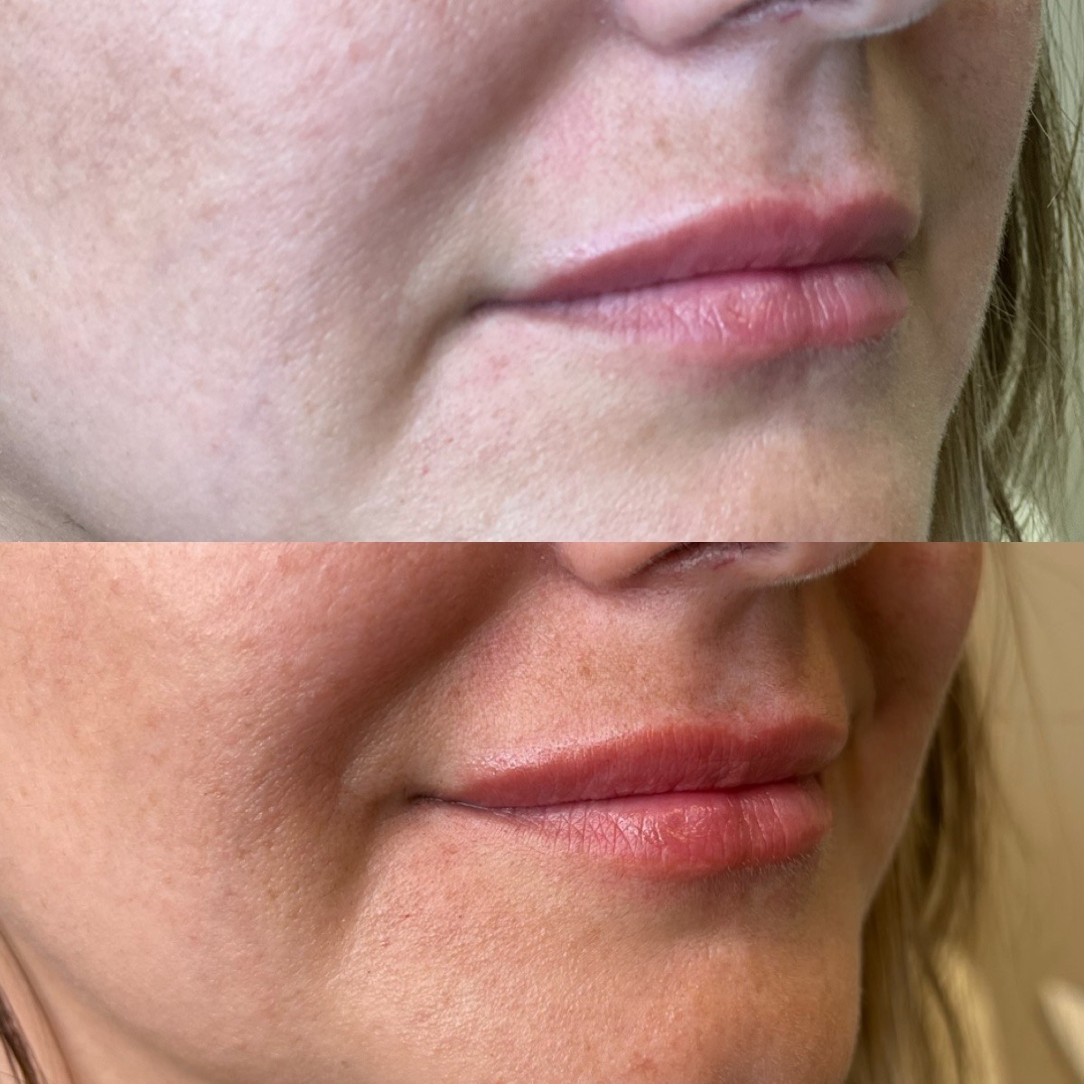 Cosmetic Injectables & Specialty Treatments Image
