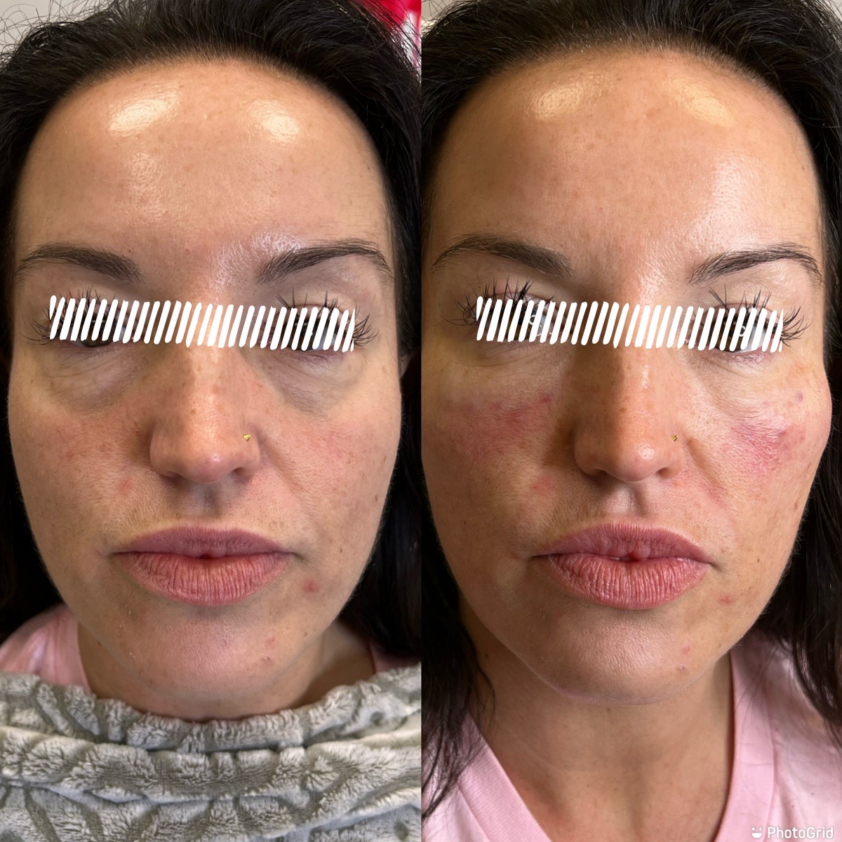 Cosmetic Injectables & Specialty Treatments Image