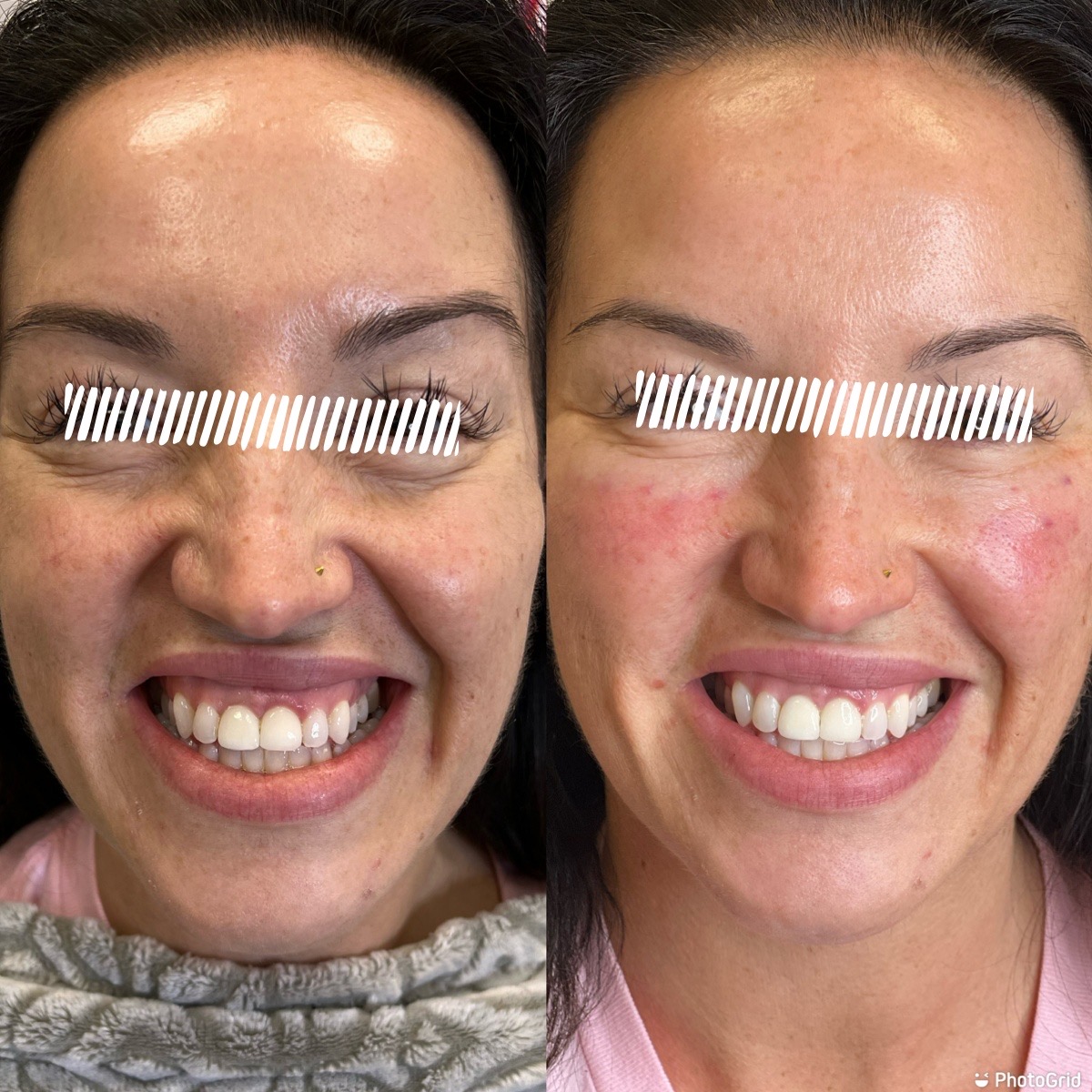 Cosmetic Injectables & Specialty Treatments Image