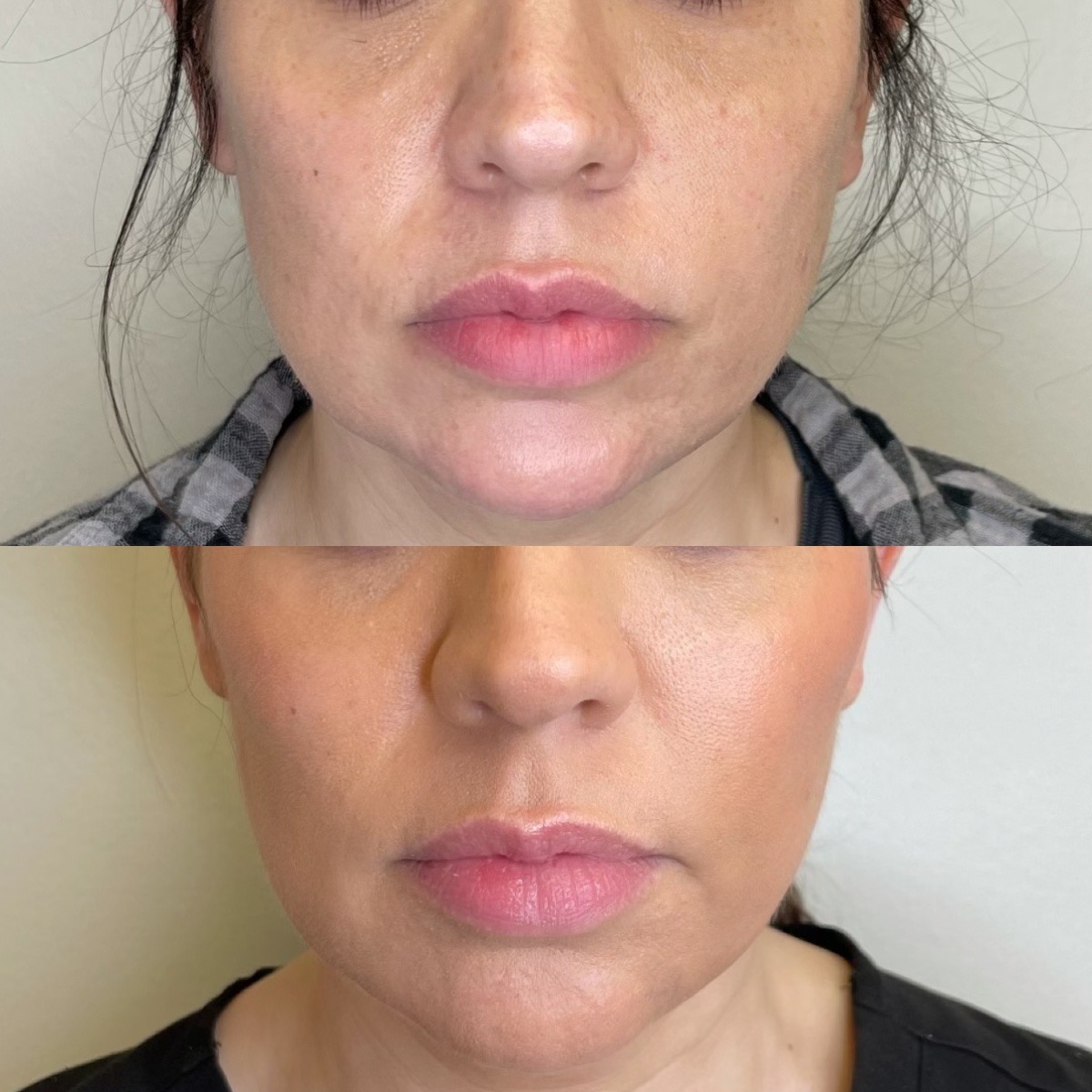 Cosmetic Injectables & Specialty Treatments Image