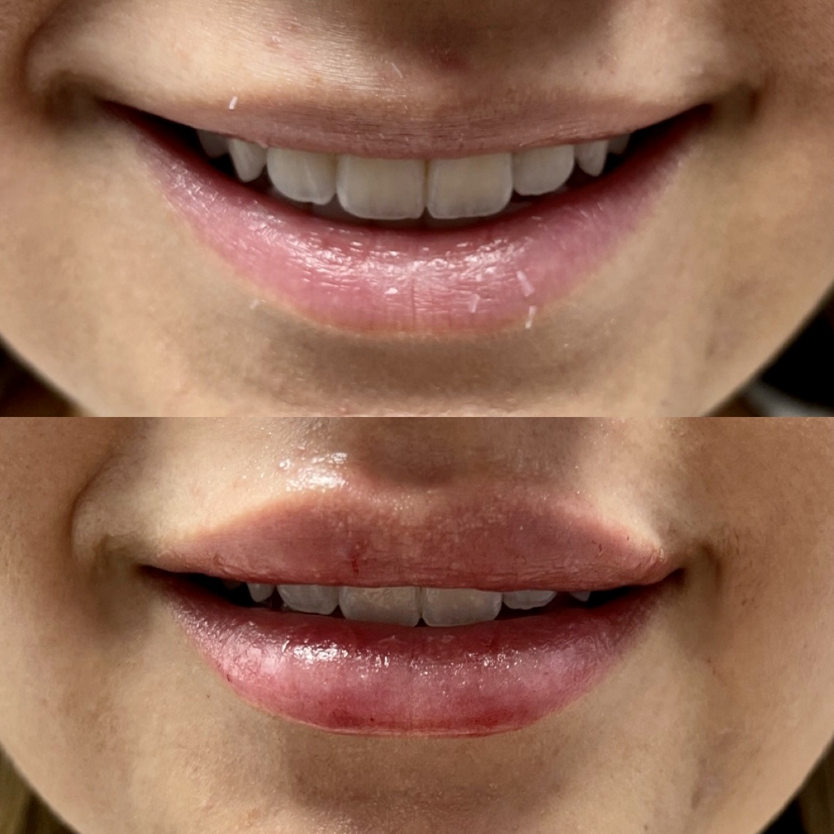 Cosmetic Injectables & Specialty Treatments Image