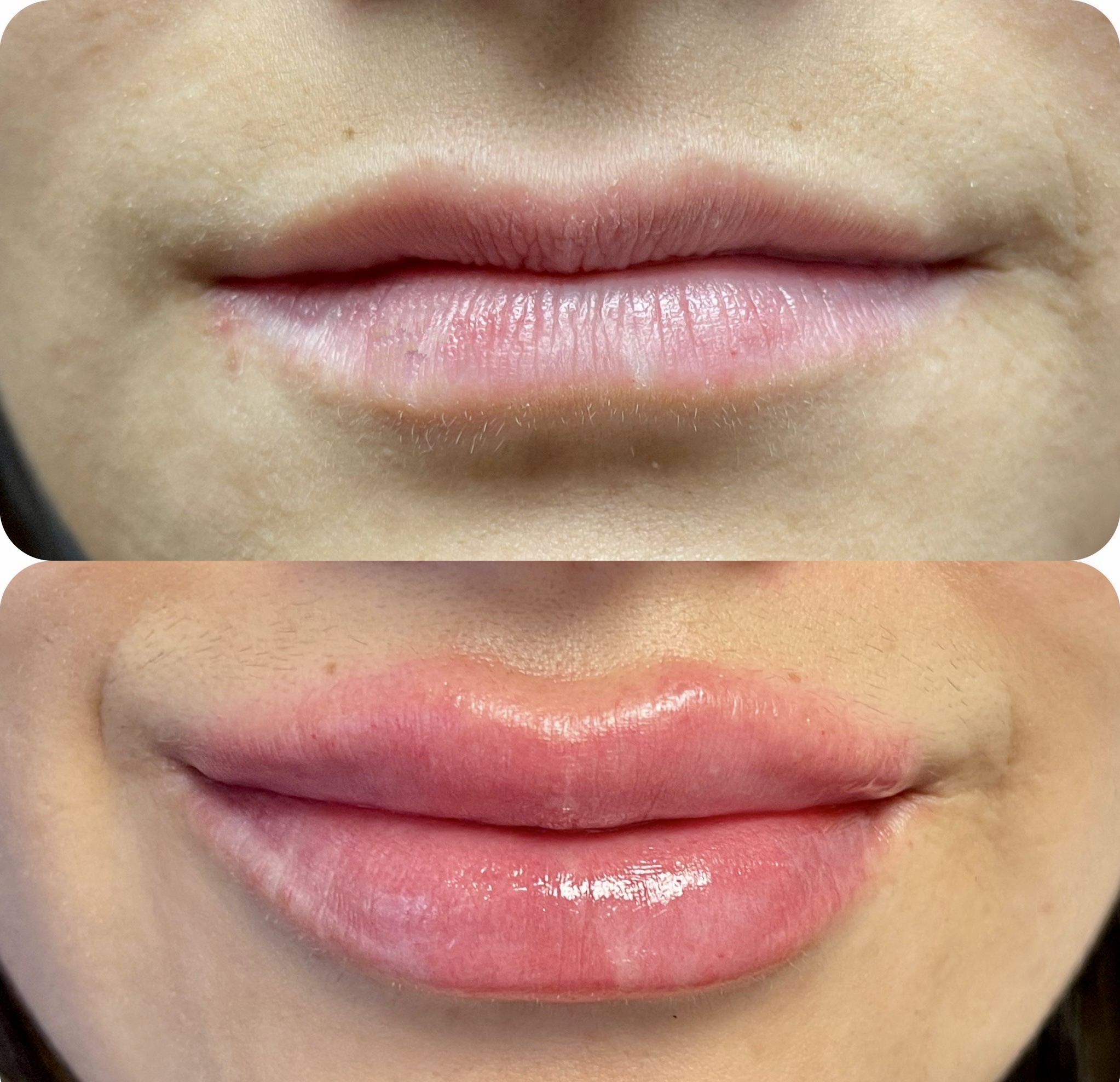 Cosmetic Injectables & Specialty Treatments Image