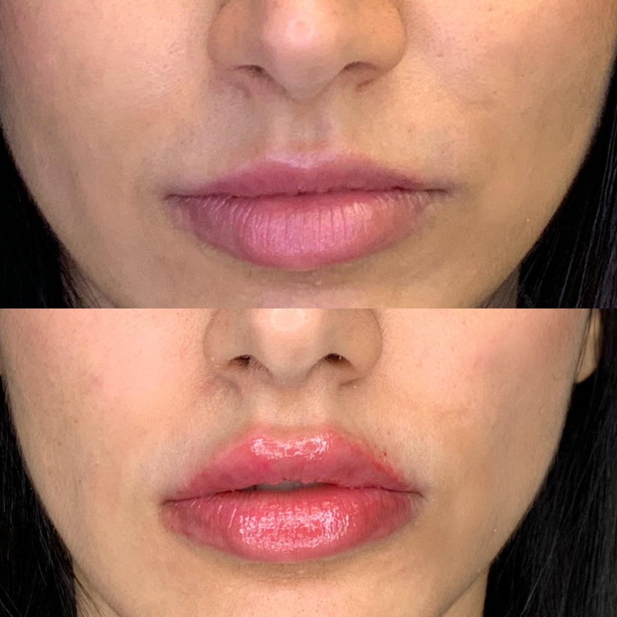 Cosmetic Injectables & Specialty Treatments Image